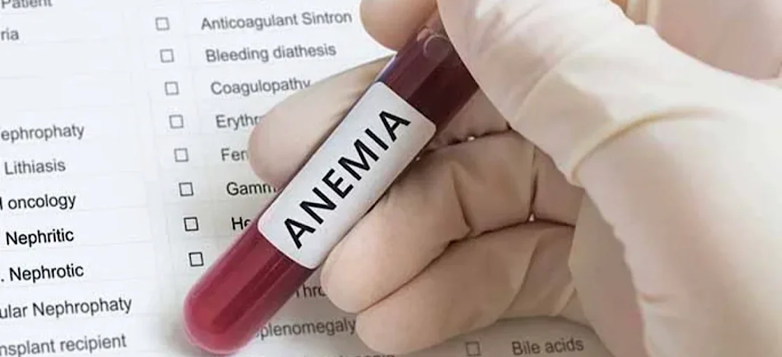 Анемия. Как её побороть?