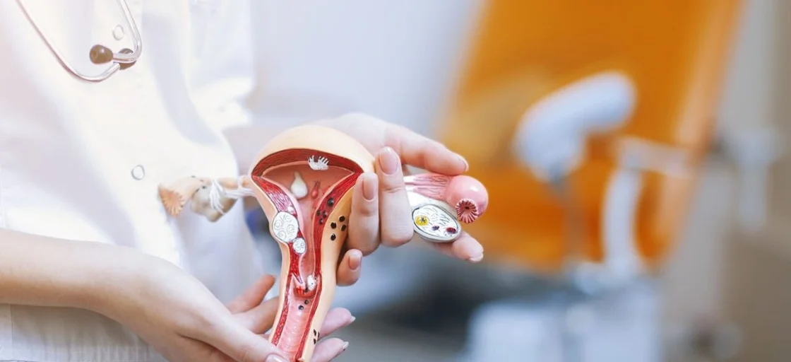 Использование ионизированной воды в лечении молочницы у женщин